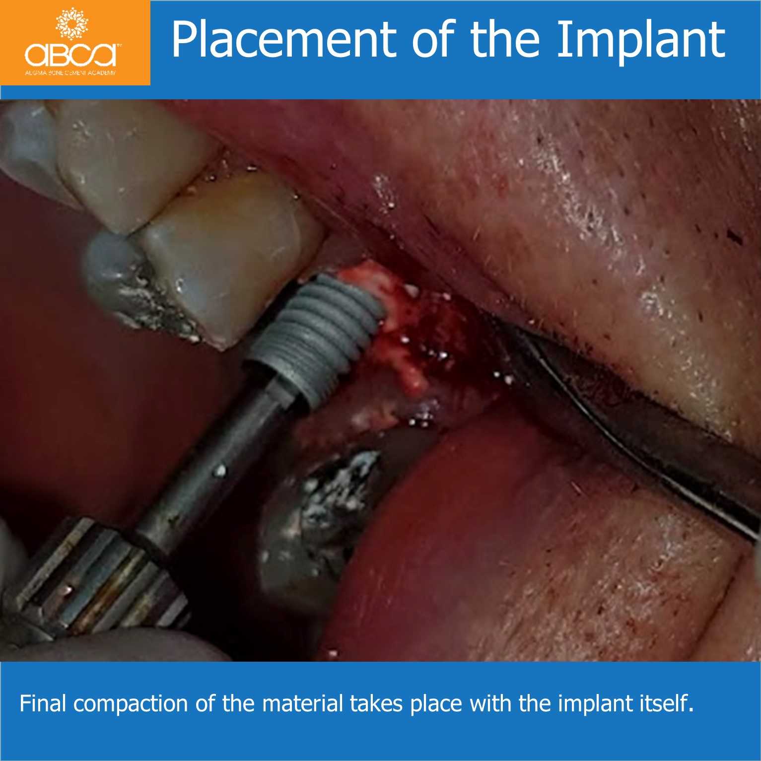 Clinical Case